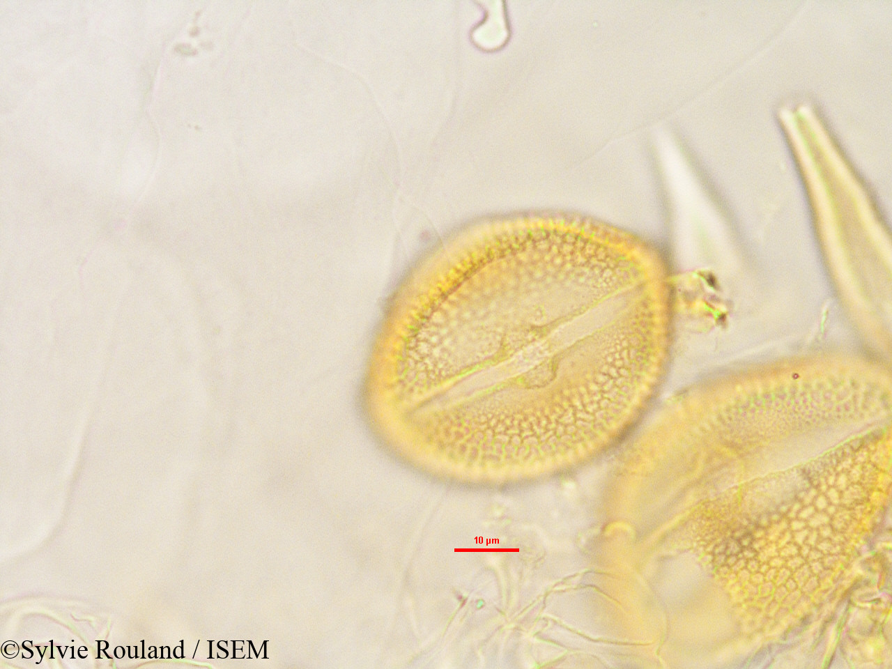 Sylvie.Rouland/Raphidocystis_sakalavensis_2846/Raphidocystis_sakalavensis_2846_0005(copy).jpg