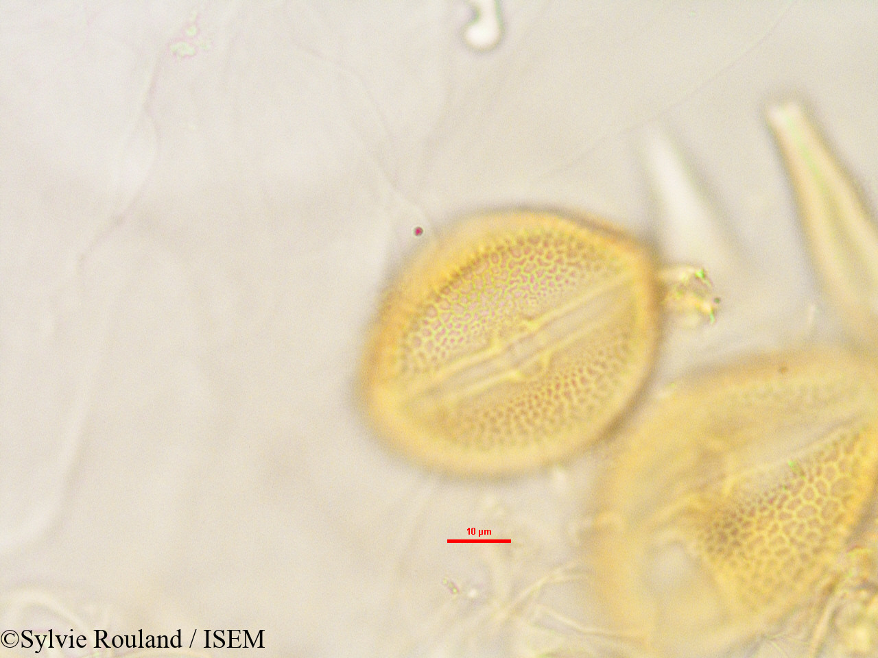 Sylvie.Rouland/Raphidocystis_sakalavensis_2846/Raphidocystis_sakalavensis_2846_0006(copy).jpg