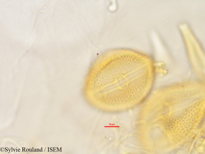 Raphidocystis sakalavensis - lame n° 2846