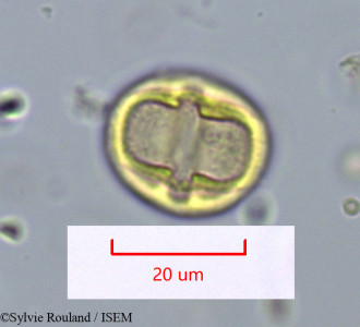 Rhizophora racemosa - lame n° 1095