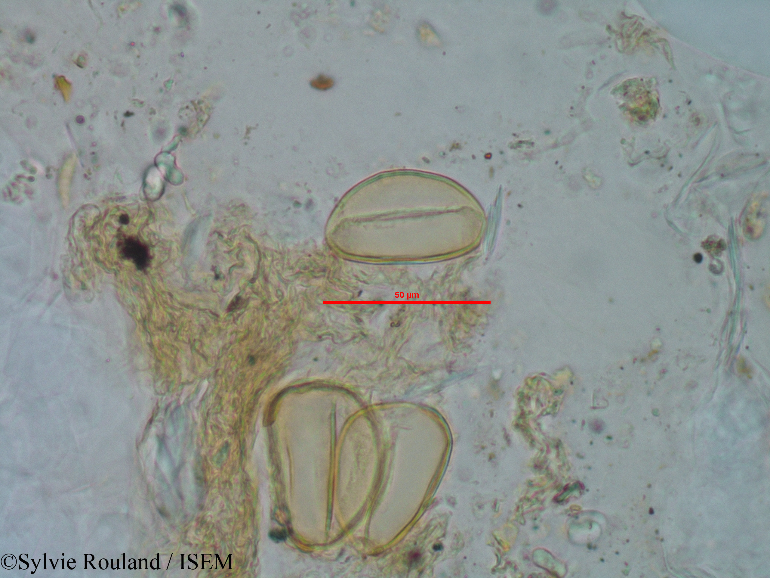 Sylvie.Rouland/Rhodocodon_calcicolus_1244/Rhodocodon_calcicolus_1244_0001(copy).jpg