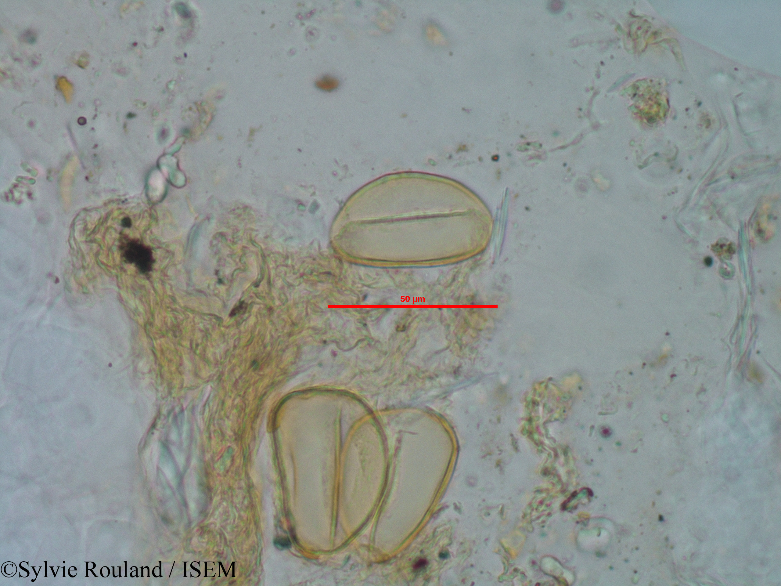 Sylvie.Rouland/Rhodocodon_calcicolus_1244/Rhodocodon_calcicolus_1244_0003(copy).jpg