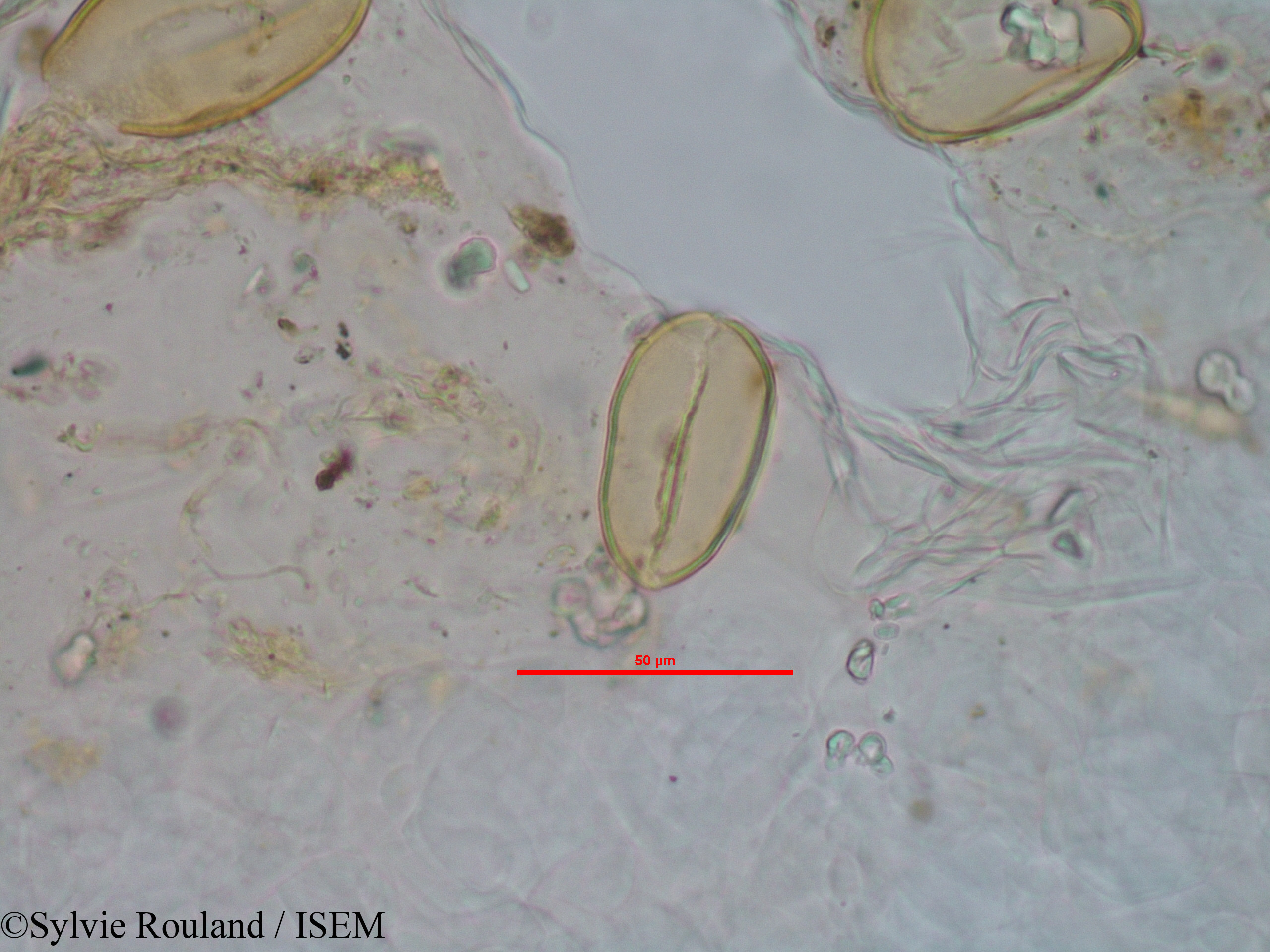Sylvie.Rouland/Rhodocodon_calcicolus_1244/Rhodocodon_calcicolus_1244_0006(copy).jpg