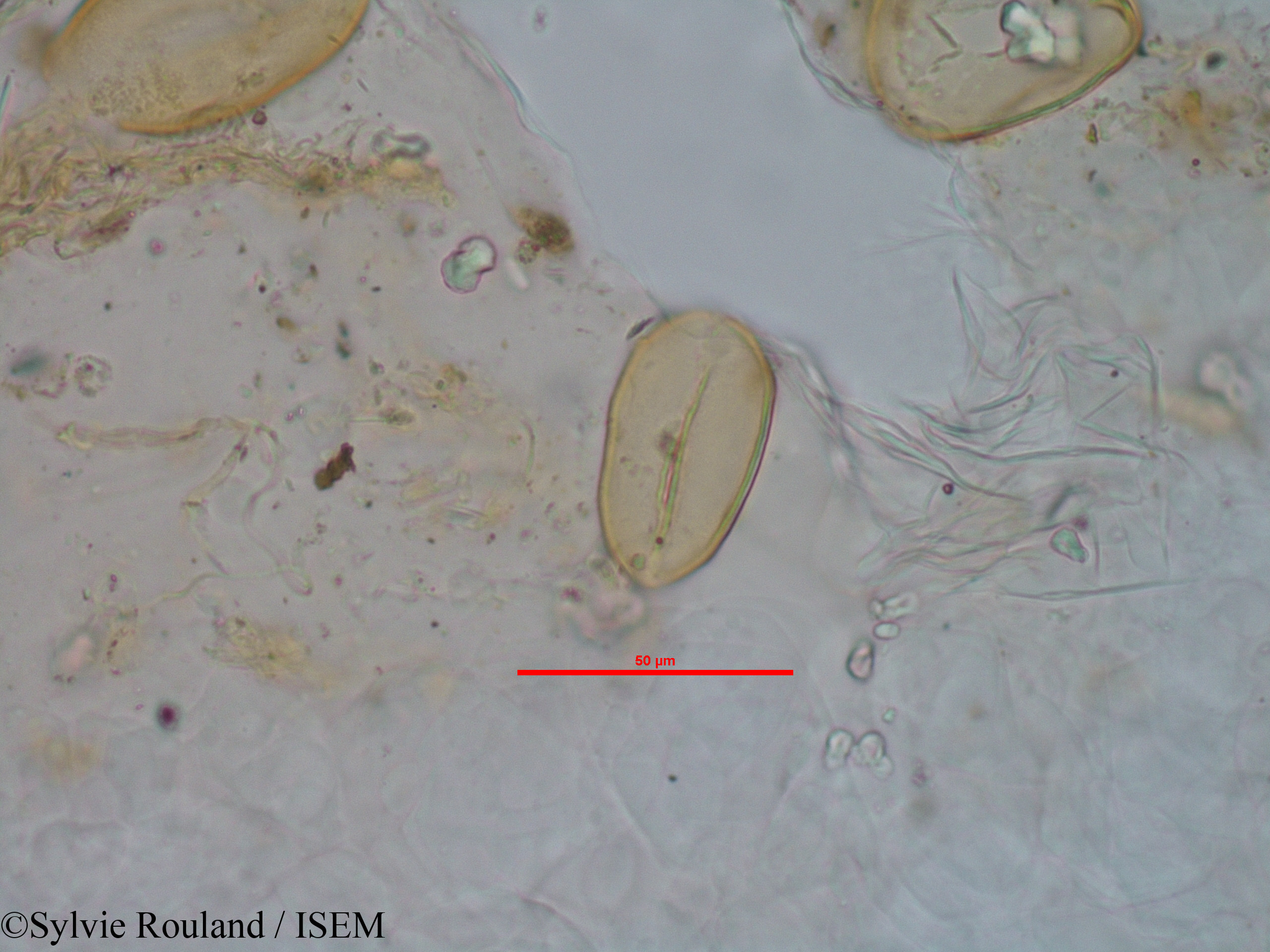 Sylvie.Rouland/Rhodocodon_calcicolus_1244/Rhodocodon_calcicolus_1244_0007(copy).jpg