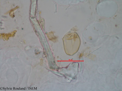 Sylvie.Rouland/Rhodocodon_urgineoides_1245/Rhodocodon_urgineoides_1245_0001(copy)_thumb.jpg