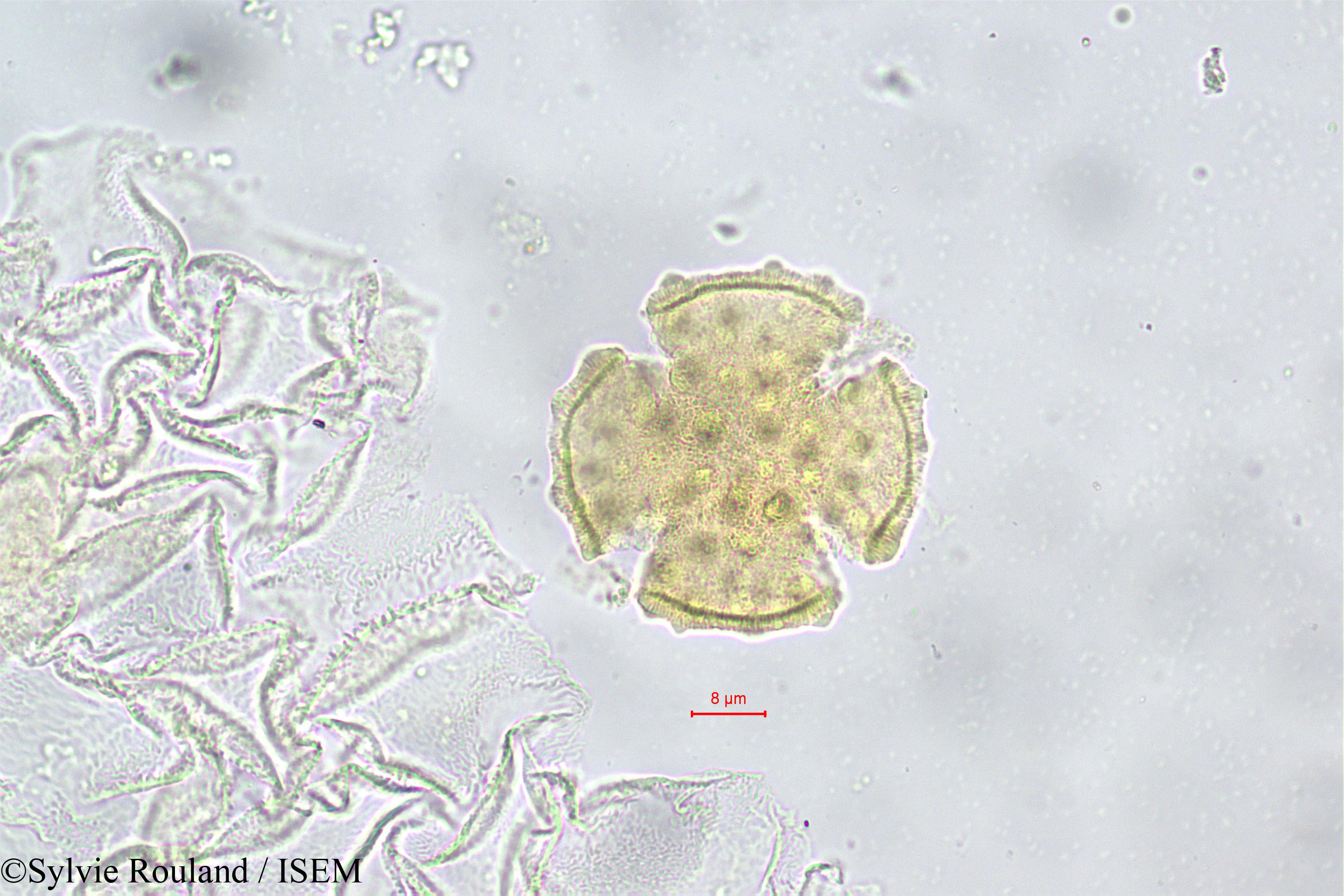 Sylvie.Rouland/Rhopalocarpus_alternifolius_149/Rhopalocarpus_alternifolius_149_0001(copy).jpg