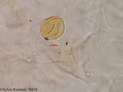 Sylvie.Rouland/Rhynchospora_humbertii_1413/Rhynchospora_humbertii_1413_0001(copy)_thumb.jpg