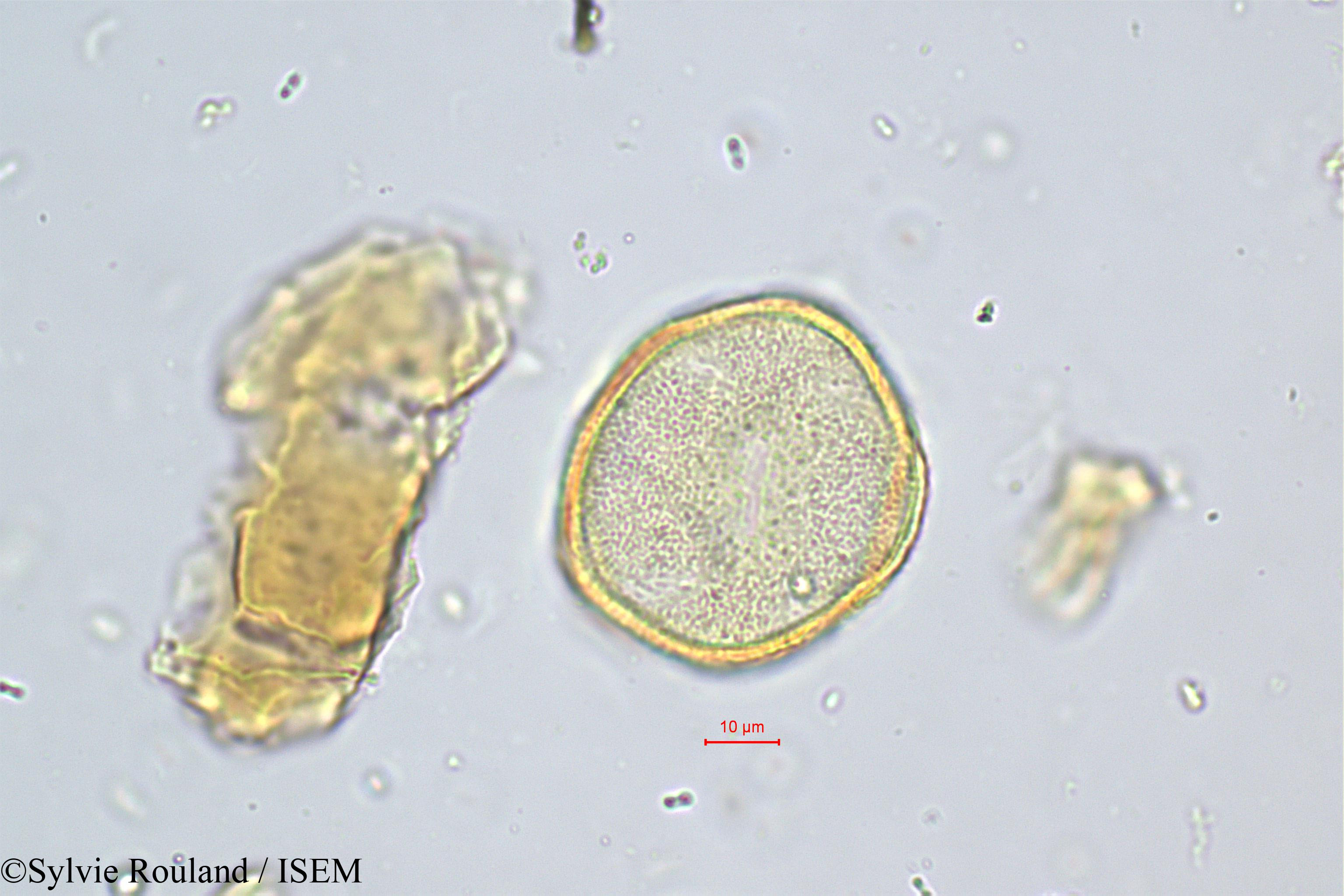 Sylvie.Rouland/Sabouraea_sartomentosa_449/Sabouraea_sartomentosa_449_0003(copy).jpg