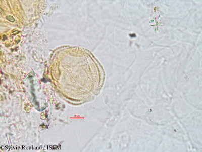 Sylvie.Rouland/Sarcobotrya_strigosa_2795/Sarcobotrya_strigosa_2795_0001(copy)_thumb.jpg