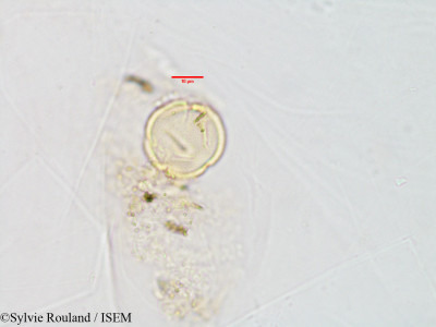 Schizenterospermum grevei - lame n° 2888