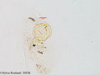 Schizenterospermum grevei - lame n° 2888