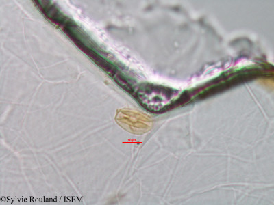Sylvie.Rouland/Sloanea_dalechampsioides_1329/Sloanea_dalechampsioides_1329_0001(copy)_thumb.jpg