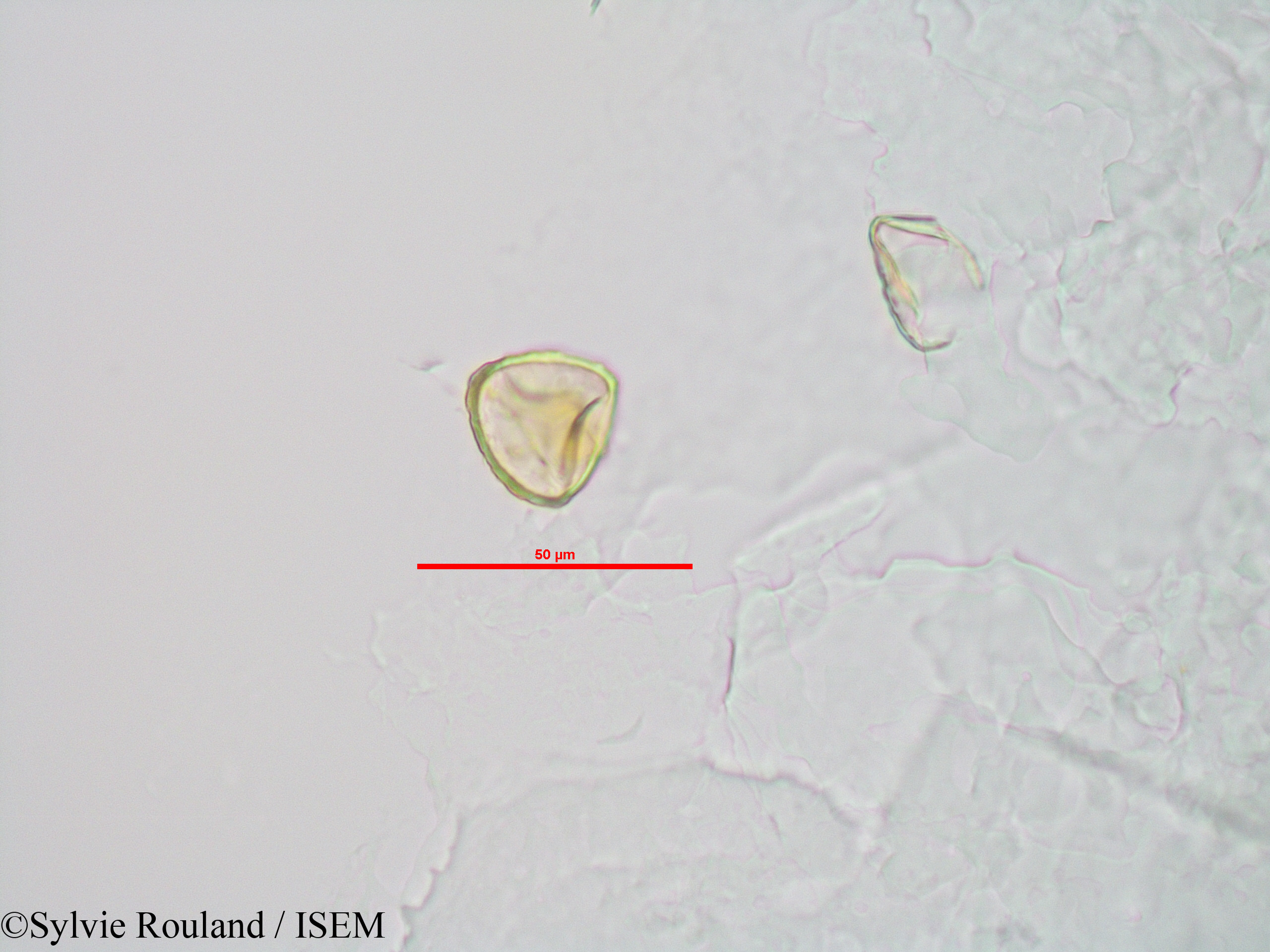 Sylvie.Rouland/Sphagnum_sp._90042/Sphagnum_sp._90042_0001(copy).jpg