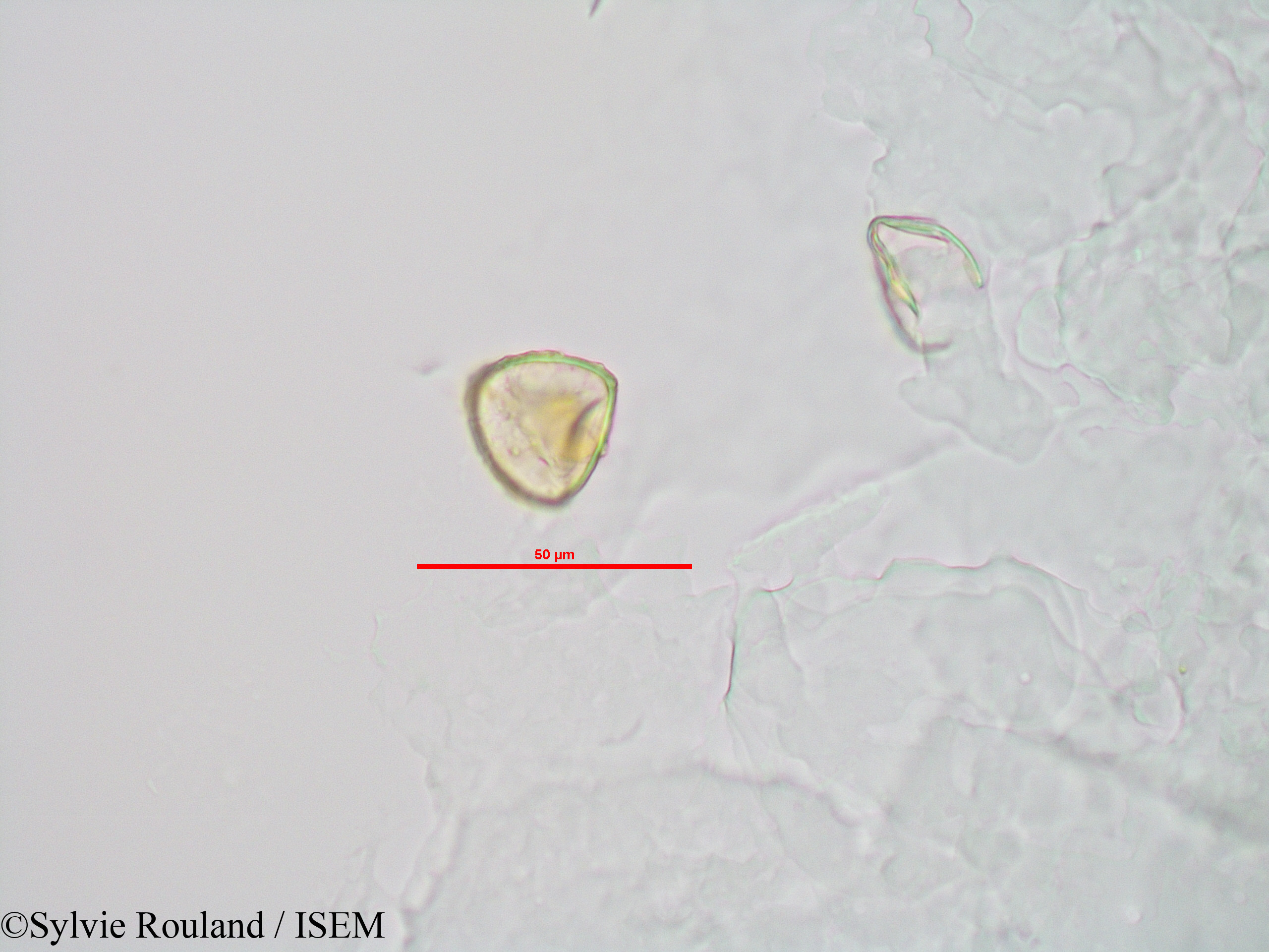 Sylvie.Rouland/Sphagnum_sp._90042/Sphagnum_sp._90042_0003(copy).jpg