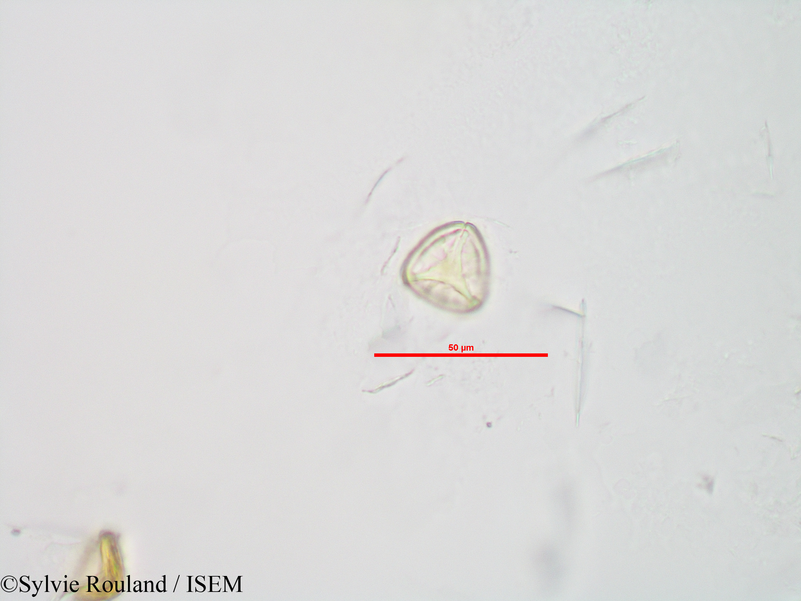 Sylvie.Rouland/Sphagnum_sp._90042/Sphagnum_sp._90042_0005(copy).jpg