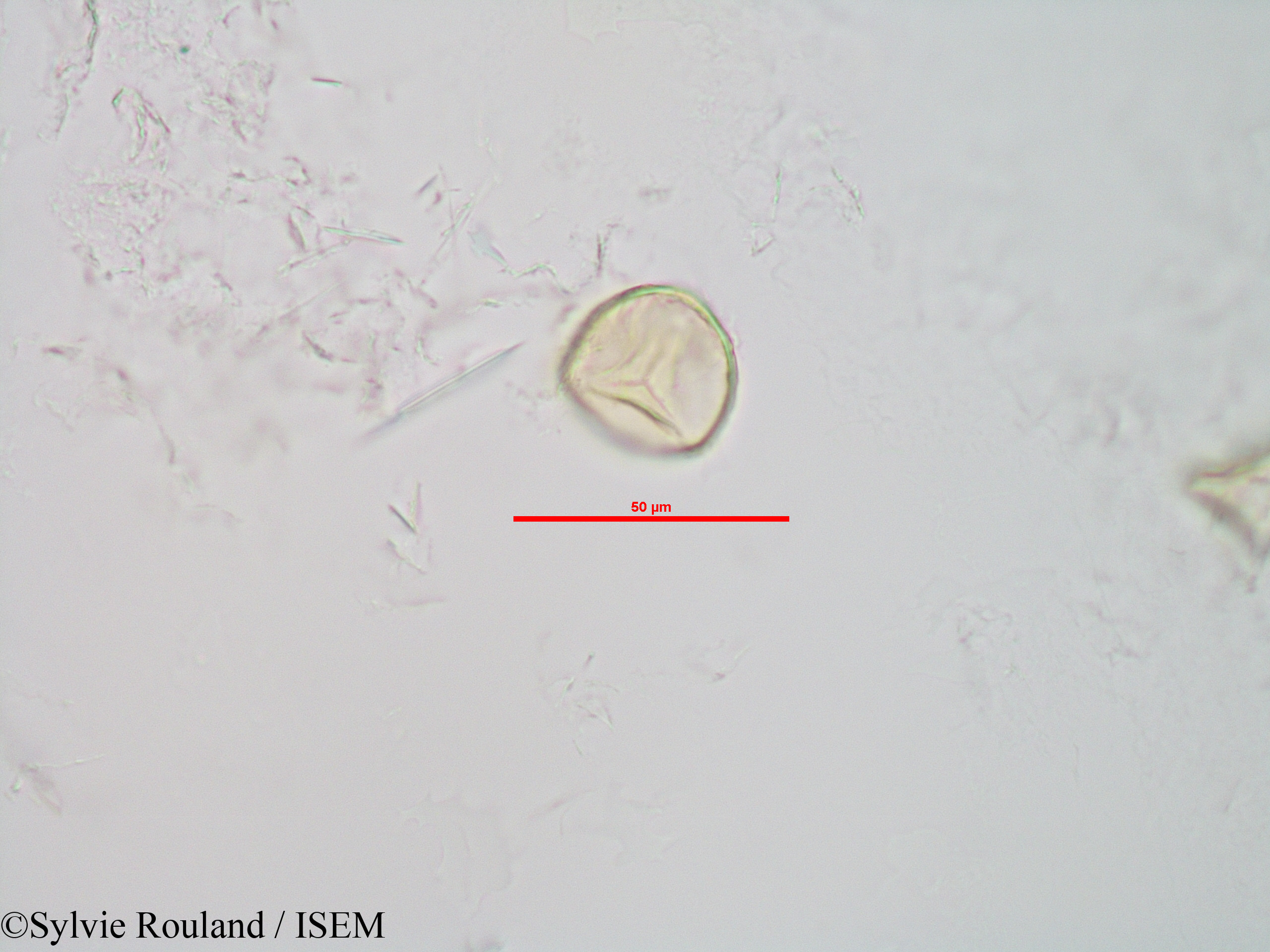 Sylvie.Rouland/Sphagnum_sp._90042/Sphagnum_sp._90042_0006(copy).jpg