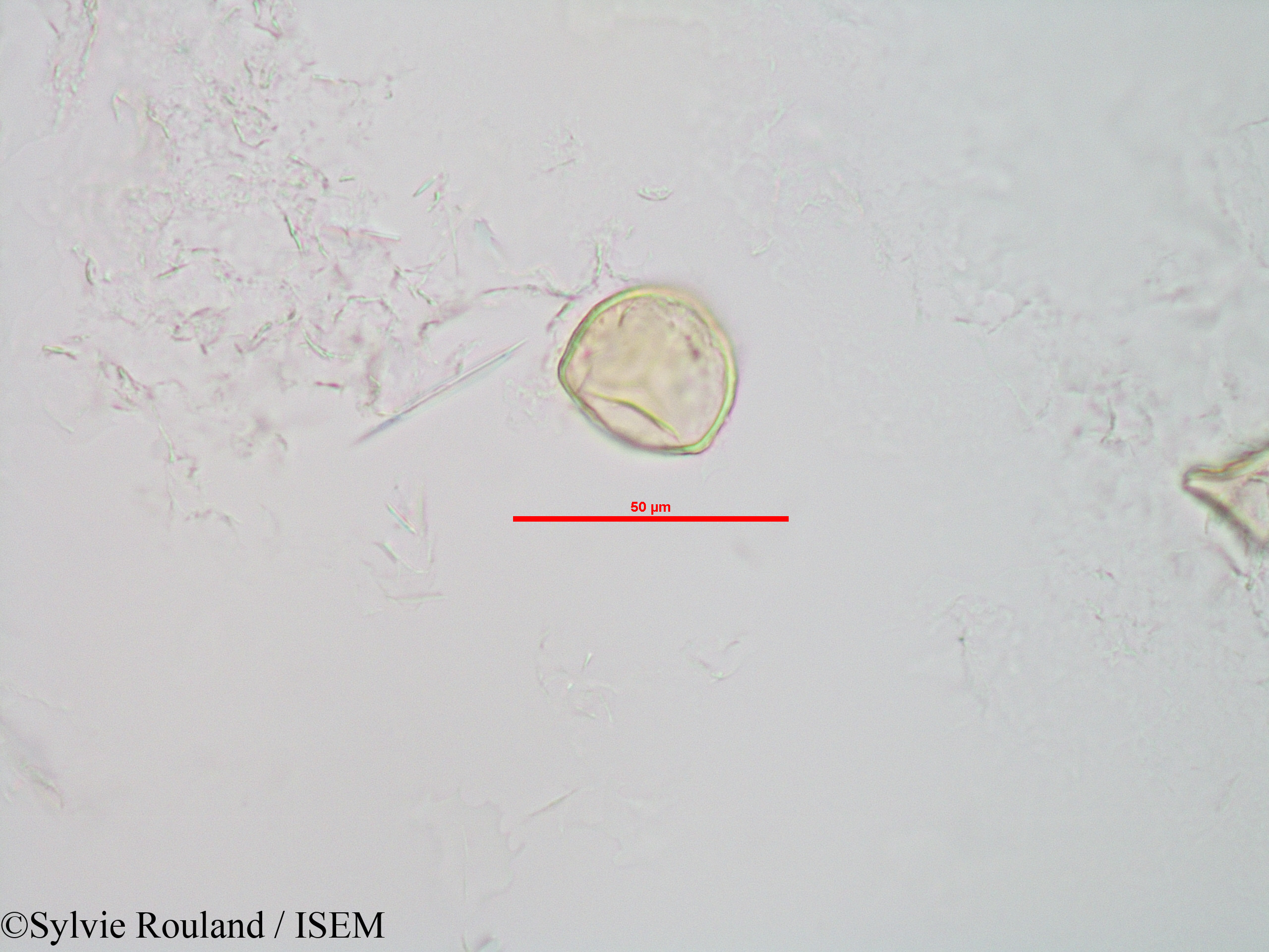 Sylvie.Rouland/Sphagnum_sp._90042/Sphagnum_sp._90042_0007(copy).jpg