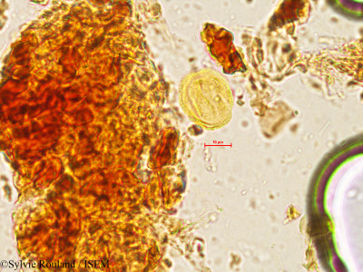 Sylvie.Rouland/Sterculia_urens_4054/Sterculia_urens_4054_0001(copy)_thumb.jpg