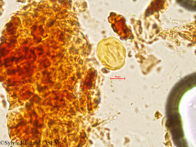 Sterculia urens - lame n° 4054