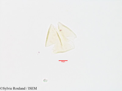 Sylvie.Rouland/Strychnos_spinosa_3200/Strychnos_spinosa_3200_0001(copy)_thumb.jpg