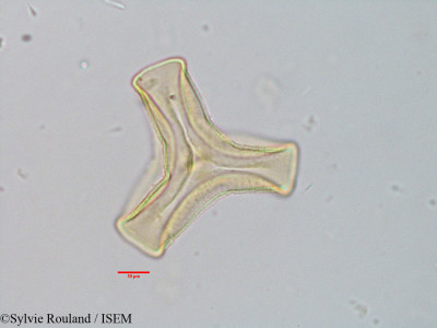 Sylvie.Rouland/Tapinanthus_globiferus_3685/Tapinanthus_globiferus_3685_0001(copy)_thumb.jpg