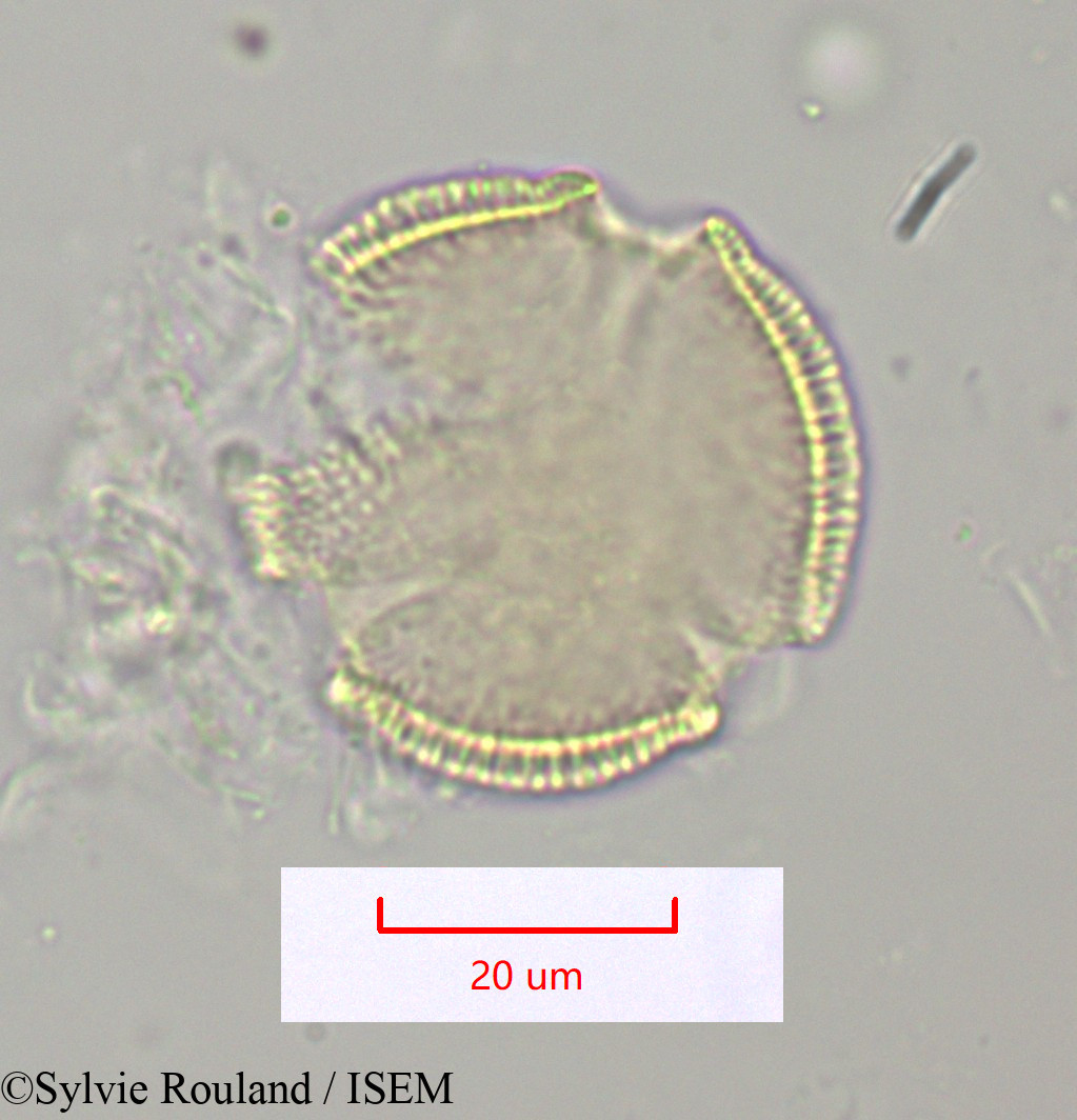 Sylvie.Rouland/Thyrsosalacia_sp_1099/Thyrsosalacia_sp_1099_0001(copy).jpg