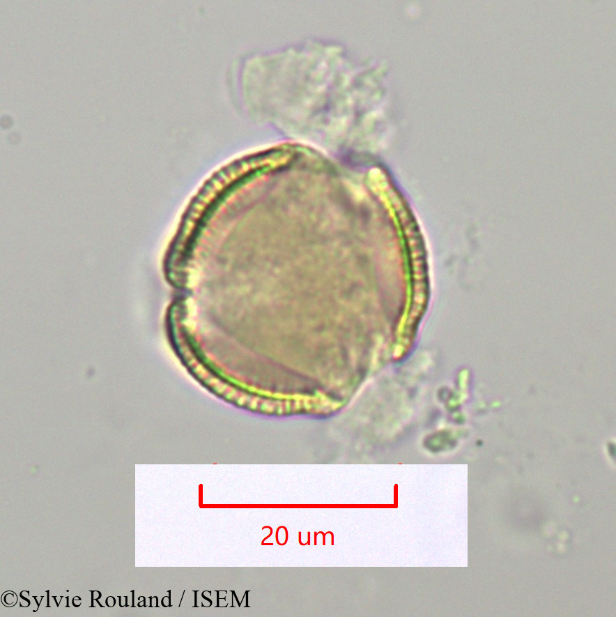 Sylvie.Rouland/Thyrsosalacia_sp_1099/Thyrsosalacia_sp_1099_0004(copy).jpg