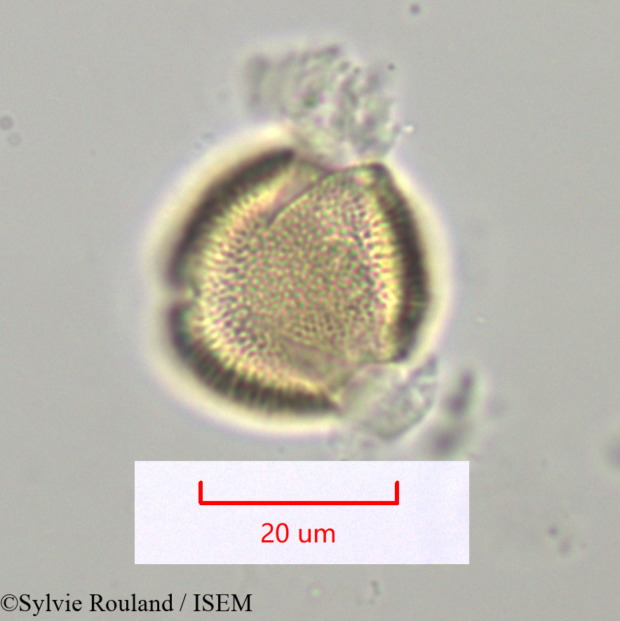 Sylvie.Rouland/Thyrsosalacia_sp_1099/Thyrsosalacia_sp_1099_0006(copy).jpg