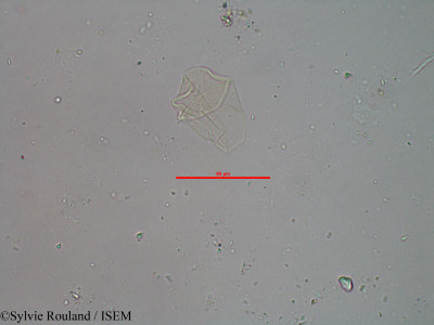 Sylvie.Rouland/Trichoschoenus_bosseri_25871/Trichoschoenus_bosseri_25871_0001(copy)_thumb.jpg