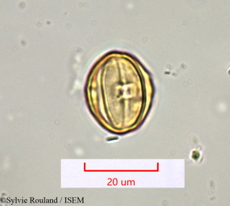 Sylvie.Rouland/Tristemma_virusanum_1368/Tristemma_virusanum_1368_0001(copy)_thumb.jpg
