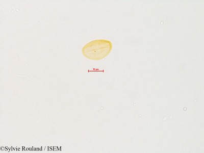 Sylvie.Rouland/Uncaria_tomentosa_4015/Uncaria_tomentosa_4015_0001(copy)_thumb.jpg