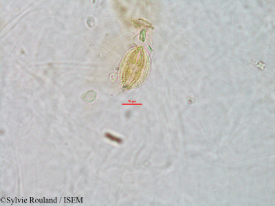 Sylvie.Rouland/Urophyllum_lyallii_2853/Urophyllum_lyallii_2853_0001(copy)_thumb.jpg