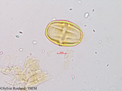 Sylvie.Rouland/Vitellaria_paradoxa_19976/Vitellaria_paradoxa_19976_0001(copy)_thumb.jpg