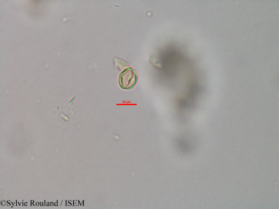 Weinmannia rutenbergii - lame n° 41494