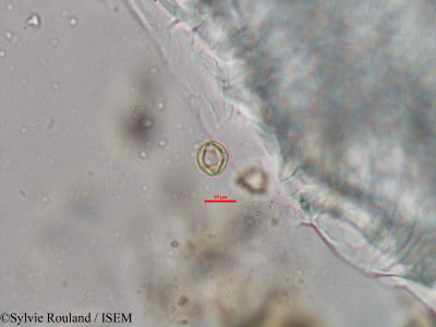 Weinmannia rutenbergii - lame n° 41494