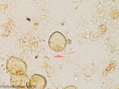 Xerophyta sessiliflora var. villosa - lame n° 2701