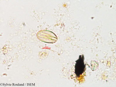 Xerophyta sessiliflora var. villosa - lame n° 2701