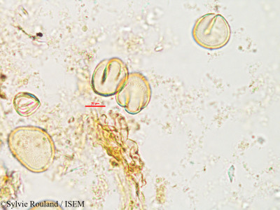 Xerophyta sessiliflora var. villosa - lame n° 2701